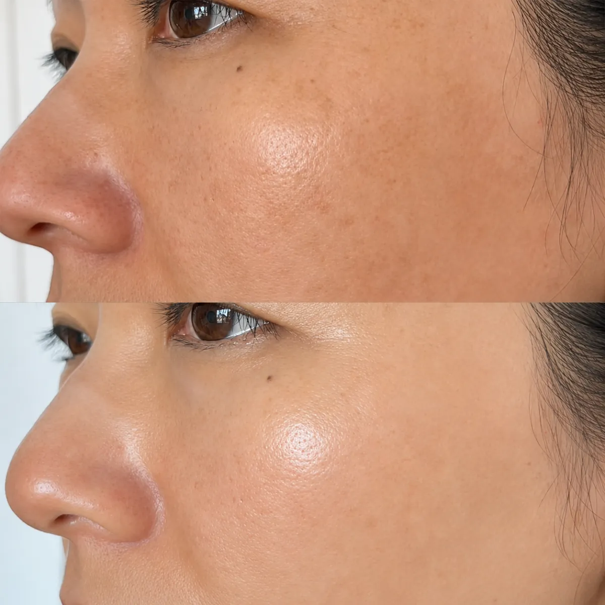 Mei, 34 — Dullness, dehydration & uneven texture — before and after